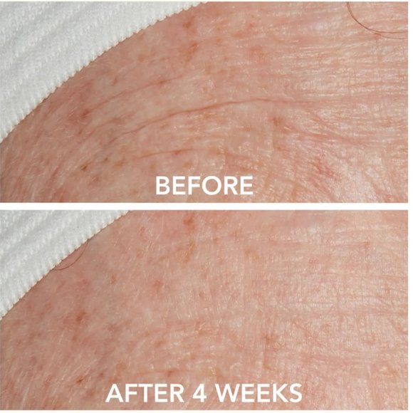 Lancer Triple Peptide Drops Vitamin E+Niacinamide, Collagen, NEW - Mini 4.5 ml - Picture 8 of 13